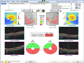 ossoptical014009.png